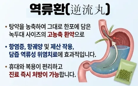 역류환 - 위장 기 순환 정상화