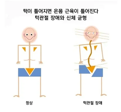 턱관절 불균형이 전신으로 퍼지는 과정 - 신경계·내분비계 장애